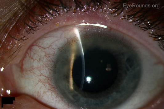 Recognizing and Treating Common Cat Eye Diseases
